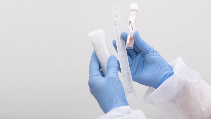 Kasu positibo bat zenbatu du Osasun Sailak PCR probetan