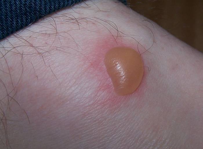 Zumaiako hitz bereziak:  PUSLO