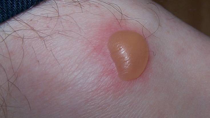 Zumaiako hitz bereziak: PUSLO