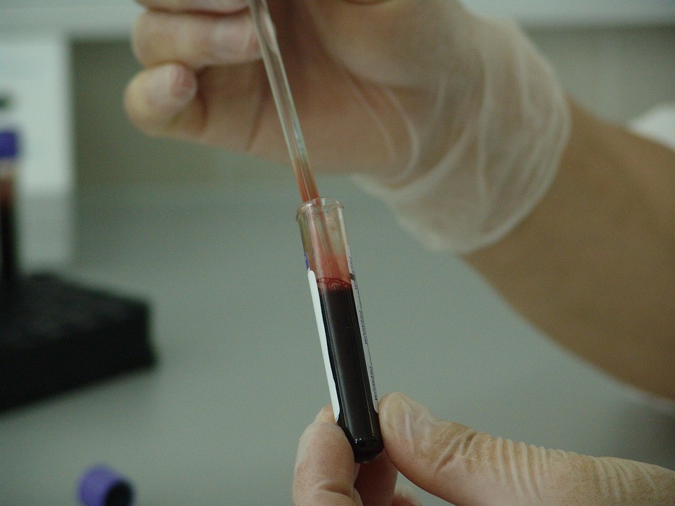 PFAS substantzia kimikoak atzeman dituzte Urolako eta Goierriko adin txikikoen odolean