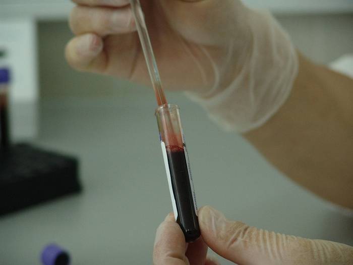 PFAS substantzia kimikoak atzeman dituzte Urolako eta Goierriko adin txikikoen odolean