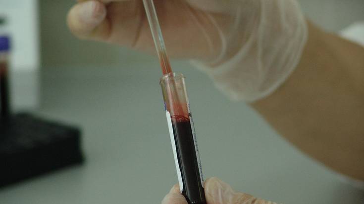 PFAS substantzia kimikoak atzeman dituzte Urolako eta Goierriko adin txikikoen odolean