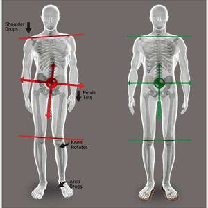 Azterketa postural eta biomekanikoak