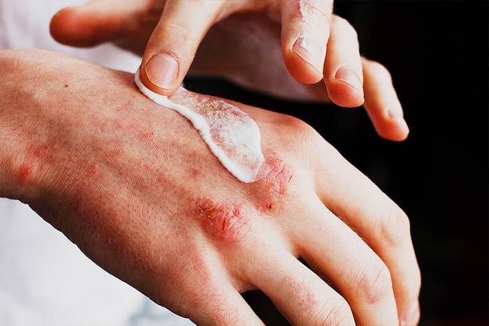 Antigoaleko Hiztegia: 'Imintzio', 'Kakerre', 'Kuluxka', 'Lantzoi' eta 'Legen'