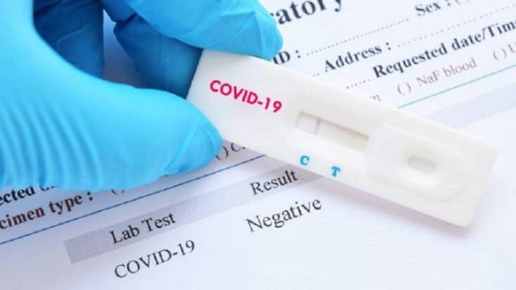 Ostegunean hasiko dira COVID-19aren autodiagnostikorako testak farmazietan saltzen
